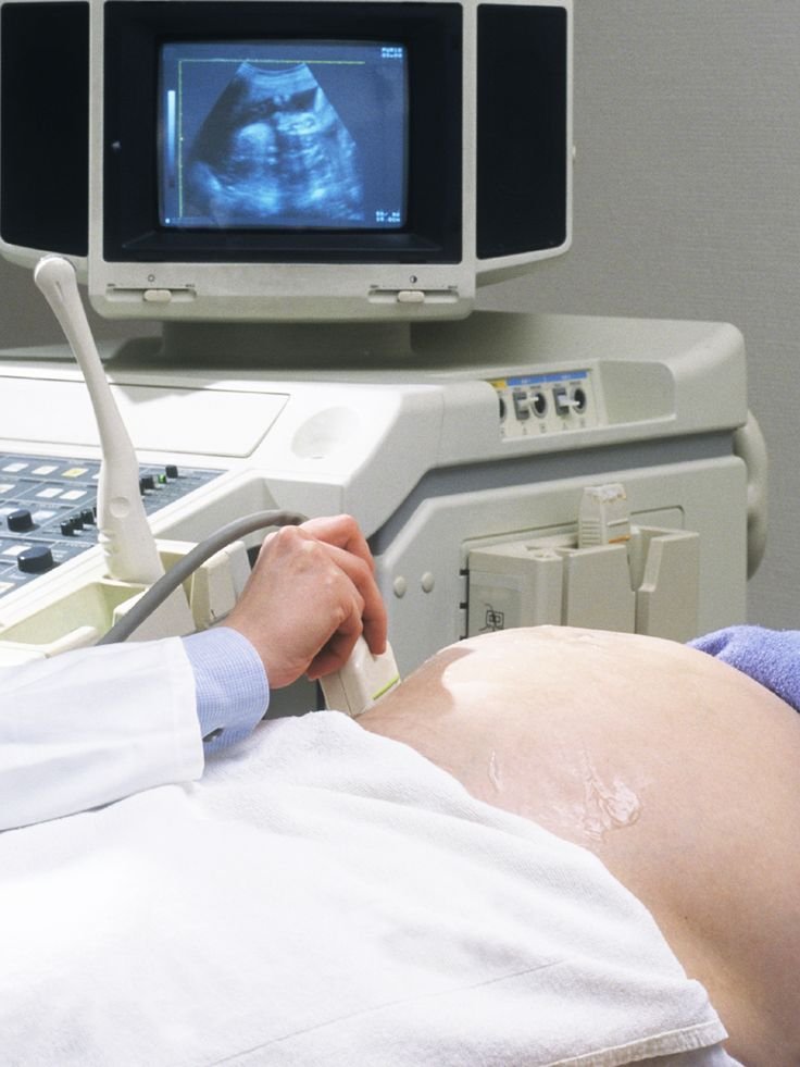 kidney-ultrasound-best-scan-centres-blood-test-diagnostic-labs